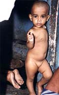 A slum child